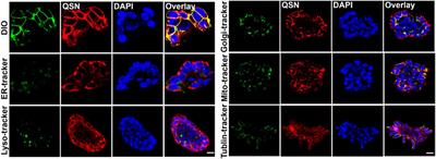 Cell membrane-targeting NIR fluorescent probes with large Stokes shifts for ultralong-term transplanted neural stem cell tracking